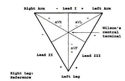 Figure 6 : Examples of direct (left) and indirect (right) contact
