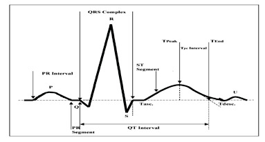 Figure 1 : Basic diagram of Four Wave Mixing