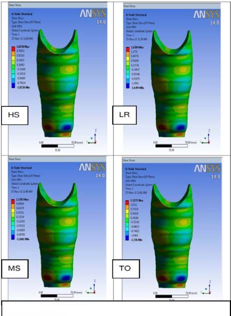 Figure 5 : SEM images of Jute nanofibres after 80hrs milling d) Mechanical Properties of nanofibre composites