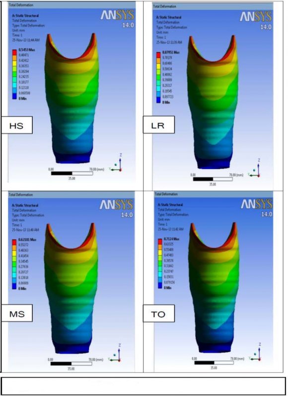 Figure 5 : Equivalent von-Mises stress at pressure tolerated areas in stance phase of gait cycle during normal walking on plane surface at a given speed
