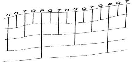 Figure 3 : Design of the grout curtain