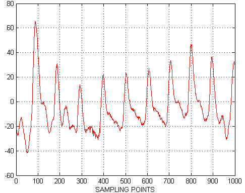 Fig 2(a) Raw PPG Signal Fig 2(b) Ground Truth of the PPG Signal