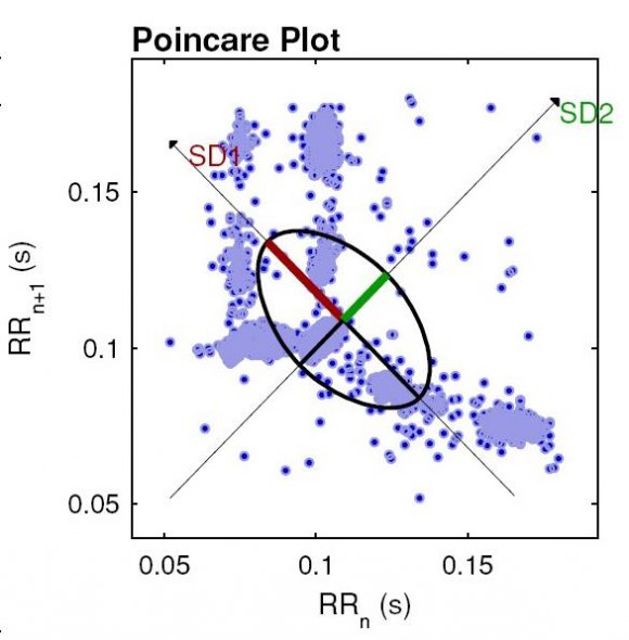 Figure 3.10 : VARIANCE for normal & abnormal patient From the above figure is seen that the SDSD VALUE for normal patients is 3.92 and for abnormal patients is 33.47.Theoretically for normal patient value of SDSD should be less than 5 and for abnormal patient value of SD should be less than 5.where correct value is achieved and clearly detect the abnormal patients. Similarly for VARIANCE perfect value is achieved to detect the normal and abnormal patients. Simulation Result of Detrended Fluctuation Analysis i. Comparison between normal and abnormal patients for DFA