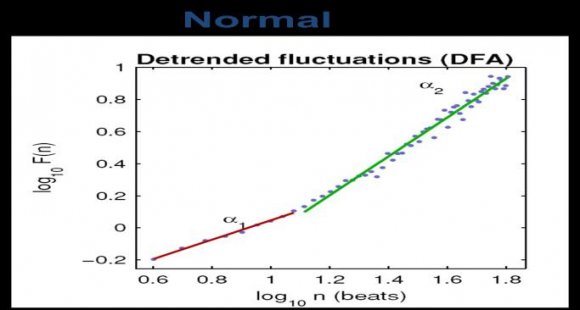 Figure 3.20 : Comparison between normal & abnormal patients (SD-4)