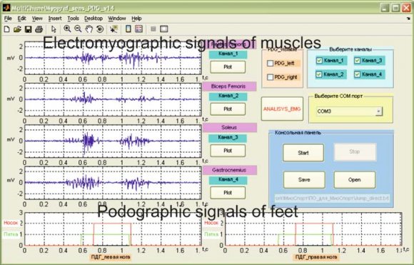 Global Journal of Researches in Engineering ( ) Volume XIX Issue V Version I F (time resolution of 3,125 ms), and data transmission via a wireless interface to a distance of up to 100 m [34-35].