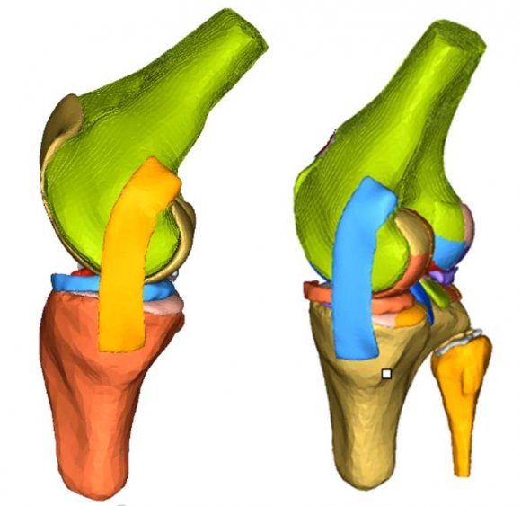 Figure 3: Sketch of 45 degree (left) and 30 degree knee (right) flexion angles before ATT is applied
