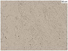 Figure 13: The microstructure of the middle sector (ferrite)