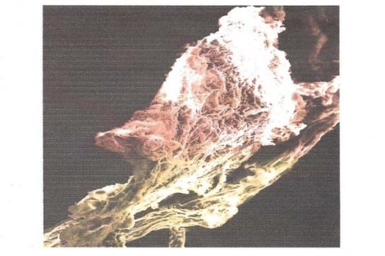 Fig. 1: SEM morphology of Sphagnum cymbifolium (moss) (X250)