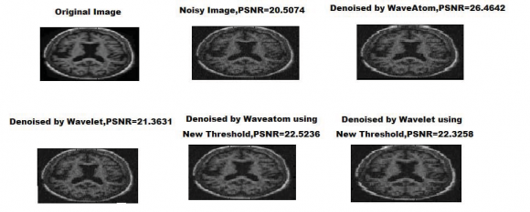 Fig.7 : Timing diagram simulated at Test bench.