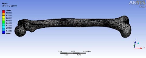 shows ramp load applied on the femur.