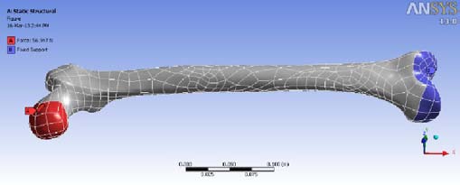 Figure 17 : Applied load on the femur
