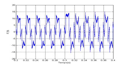 Figure 3 (a) : Audiogram from test subject indicating substantial hearing loss in the left ear